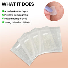 Acne Pimple Patch, Absorbing Hydrocolloid Original, Hydrocolloid Acne Pimple Patch, Patches for Blemishes and Zits Cover, Spot Stickers for Face and Body, 3 Size, Vegan and Cruelty Free (10 Count)
