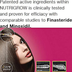 Anti Hair Loss & Faster Growth Shampoo for Dry & Normal Hairs (300ml)