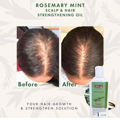 ican London Rosemary Mint Scalp & Hair Treatment Oil For Faster Hair Growth 100ml