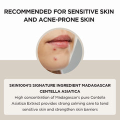 SKIN1004 Madagascar Centella Ampoule 55ml / 1.85 FL.OZ | For soothing sensitive and acne-prone skin