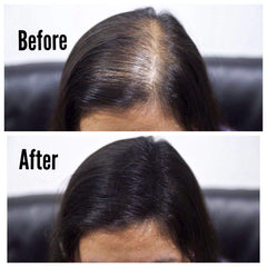 THICK FIBER Hair Building Fibers for Thinning Hair & Bald Spots (BLACK, Pack of 3) - 25g Bottle - Conceals Hair Loss in Seconds - Hair Fiber concealer for Men & Women