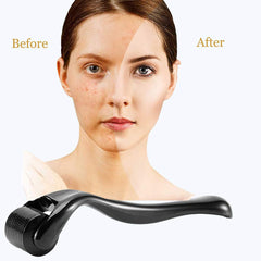 Derma Roller 2.0mm, 540 Titanium Microneedle Roller for Face Facial Wrinkles Hair Loss Stretch Marks Hair Regrowth Micro Needles Professional Microneedling Derma Needling Kit with Case