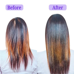 Batana & Rosemary Oil Hair Growth Treatment – Strengthens Follicles, Nourishes Scalp, Repairs Damage, Anti-Hair Loss Solution, Natural Ingredients, Suitable for All Hair Types (300mL)