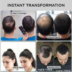 THICK FIBER - Hair Fibers for Thinning Hair (Black) 25g Bottle, Hair Loss concealer for Men & Women