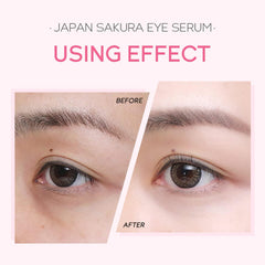Azonee 2-in-1 Sakura Eye Serum and Eye Roller, Eye Serum For Dullness, Dryness, Fine Lines, Repair Wrinkles Under The Eyes, Intense Hydrating Eye Treatment Serum Oil