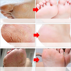ALIVER Foot Peel Mask 3 Pack, Foot Masks Exfoliating, Lavender Exfoliator for Callus, Dead Skin, Repair Rough Heels for Women Men