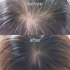 Scalp&Hair Serum for Thinning Hair by Vivelab,15ml–Clinically Tested,Nourishing Formula with Biotin,peptide. Promotes Healthy Scalp&Fuller-Looking Hair