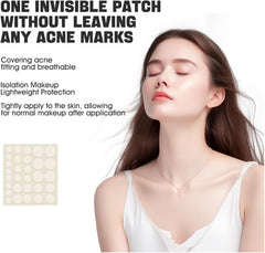 Acne Pimple Patches, Hydrocolloid Acne Patches with Tea Tree Oil,Salicylic Acid & Calendula Oil,Pimple Patch for Face, Zit Patches,Pimple Stickers(150 Count)