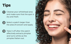 ANUA-RB Acne Pimple Patch, Absorbing Hydrocolloid, 3 Sizes, Blemishes and Zits Cover, Spot Stickers for Face and Body, Not Tested on Animals, No Toxic Ingredients, 48 Count (Pack of 2)