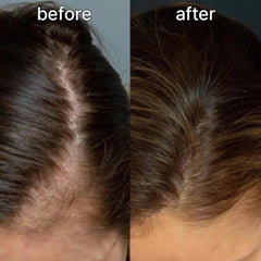 Scalp&Hair Serum for Thinning Hair by Vivelab,15ml–Clinically Tested,Nourishing Formula with Biotin,peptide. Promotes Healthy Scalp&Fuller-Looking Hair