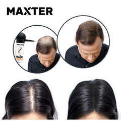 Maxter HAIR FIBER for Men & Women - 100% Natural Powder for Hair Building, Thickening and Cover Hair Loss in just 10 sec - Dark Brown x2 Bottles