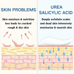GraGra Urea Cream, 2 Pcs Urea Foot Cream, Premium Urea Foot Cream, Skin Care Moisturizer, For Feet, Hands, Heels, Elbows, Knees and More, Deep Moisturizes, Callus Remover and Soften