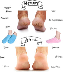 Pnrskter Moisturizing Socks, Gel Socks Soft Moisturizing Gel Socks, Gel Spa Socks for Repairing and Softening Dry Cracked Feet Skins, Gel Lining Infused with Essential Oils and Vitamins