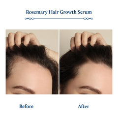 Blue Nectar Advanced Plant-Based Rosemary Hair Growth Serum, Natural Alternate for Redensyl for Hair Growth | Ayurvedic Hair Serum for Women & Men for Healthy Hair & Scalp (8 Herbs, 100 ml)