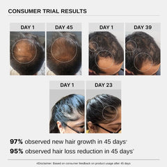 Bare Anatomy Advanced Hair Growth Serum | 3% Redensyl + 4% Anagain + 3% Baicapil + 1% Capilia Longa, Rosemary, Biotin & Rice Extract | Hair growth & Hair fall control serum for Women & Men | Pack of 3