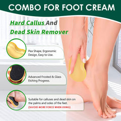 KANZA - Urea Cream for Cracked Feet,Hands with Foot File Combo Set | Callus Remover Hand Cream, Foot Cream for Dry Cracked Feet, Hands, Heels, Elbows, Nails, Knees | For Men And Women | 100g