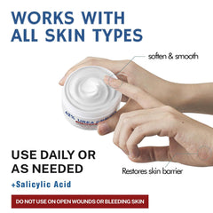 NIKITA.VIVI Urea Cream 42% plus Salicylic Acid 2% 150G for Dry Cracked Feet, Heels, Elbows, Knees, Hands Repair Treatment Lotion, Moisturizes and Removes Calluses, Corns, Dead Skin & Softens Toenails