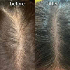 Scalp&Hair Serum for Thinning Hair by Vivelab,15ml–Clinically Tested,Nourishing Formula with Biotin,peptide. Promotes Healthy Scalp&Fuller-Looking Hair