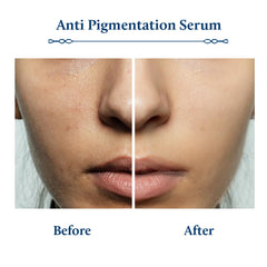 Blue Nectar Plant Based Kojic Acid Serum for Pigmentation & Dark Spots Removal | Anti-Pigmentation Face Serum for Women & Men with Rice Water & Mushroom | Lightweight | All Skin Types (13 Herbs,30ml)