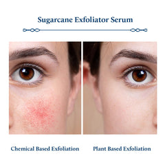 Blue Nectar AHA Exfoliating Face Serum with Plant Based Glycolic Acid from Sugarcane for Deep Exfoliation | AHA Peeling Solution for Blackheads & Tan Removal |10 Min Facial Exfoliation (14 Herbs,30ml)