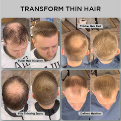 THICK FIBER - Hair Fibers for Thinning Hair (Light Brown) 25g Bottle