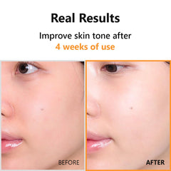 ISNTREE HYPER VITAMIN C 23 SERUM