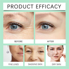 Jojoba Oil Organic Cold Pressed (100ml) – Anti-Wrinkle & Skin Tightening Facial & Body Oil, Hydrating Essential Oil for Skin Care, Massage & Fine Line Treatment