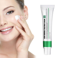 Excefore Acne Treatment Cream, 30 Day Supply, Treatment for Face with Aloe Essence, Gentle Skin Care for Acne Prone Sensitive Skin, Acne Cream Back Acne Treatment Cream for Teens & Adults, 20g Tube