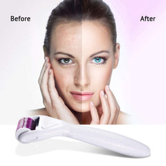 WinCheer Derma Roller Kit for Face and Body, 6 in 1 Titanium Microneedling Dermaroller Cosmetic Needling Instrument Microneedle with 5 Replaceable Heads for Face and Body Skin Care 0.25mm 300/720/1200