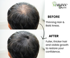 Organic Hair Growth Oil Serum 30ml | Strengthening Treatment with Organic Castor, Jojoba, Hemp Seed, Avocado & Sesame Oils + Essential Oils (Cedarwood Atlas, Peppermint, Tea Tree, Lavender, Niaouli