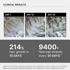 Bare Anatomy Advanced Hair Growth Serum | 3% Redensyl + 4% Anagain + 3% Baicapil + 1% Capilia Longa, Rosemary, Biotin & Rice Extract | Hair growth & Hair fall control serum for Women & Men | Pack of 3