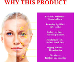 WHITESILK [(15%) Matrixyl ®― FORTE] Line Reducing & Lifting TRIPLE Action Serum― comprehensive skin rejuvenation―with (2%) Argireline + Carnosine, Penta-Exosome, Vitamin B3, HA (30ml, 1oz)