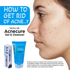 SKINLAB Acnecure Anti-Acne Face Cleanser | Disinfects Acne Prone Skin | With Salicylic Acid and Tea Tree Oil | 100ml