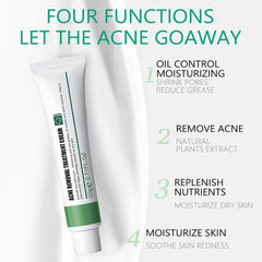 Excefore Acne Treatment Cream, 30 Day Supply, Treatment for Face with Aloe Essence, Gentle Skin Care for Acne Prone Sensitive Skin, Acne Cream Back Acne Treatment Cream for Teens & Adults, 20g Tube