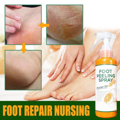 JANGOU 2pcs Foot Peel Spray - Foot Peeling Spray Orange Oil, Tea Foot Peeling Spray, Instant Feet Peeling Spray, Callus Off Foot Reglow Spray, Remove Dead Skin (B)