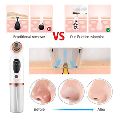 Micro-Vibrating Facial Cleanser for Shrinking Pores, Waterproof and Rechargeable Skin Cleanser, Blackhead Remover, Gentle Facial Massager for Deep Pore Cleaning | Designed in the UAE