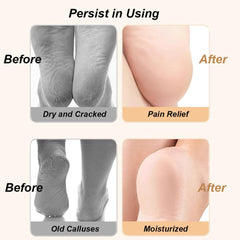 Paratoland 2 Pairs Silicone Socks for Dry Cracked Feet - Silicone Moisturizing Socks for Women - Foot Care Silicone Socks - Spa Gel Socks Foot Care After Pedicure