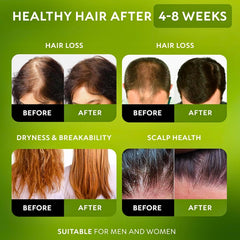 Batana Oil Organic Hair Cream - 100% Natural Batana Oil for Hair Growth, Prevent Hair Loss, Eliminate Split Ends, Repair Damaged Hair, Honduras Raw Botana Oil Hair Growth Thick Cream for Women & Men