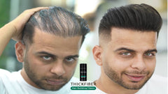 THICK FIBER Hair Building Fibres (Pack of 1, BLACK) Hair Fibres for Thinning Hair | Hair Powder for Thinning Hair 12g Bottle | Make Hair Look Thicker in Seconds with hair filler | for Women & Men