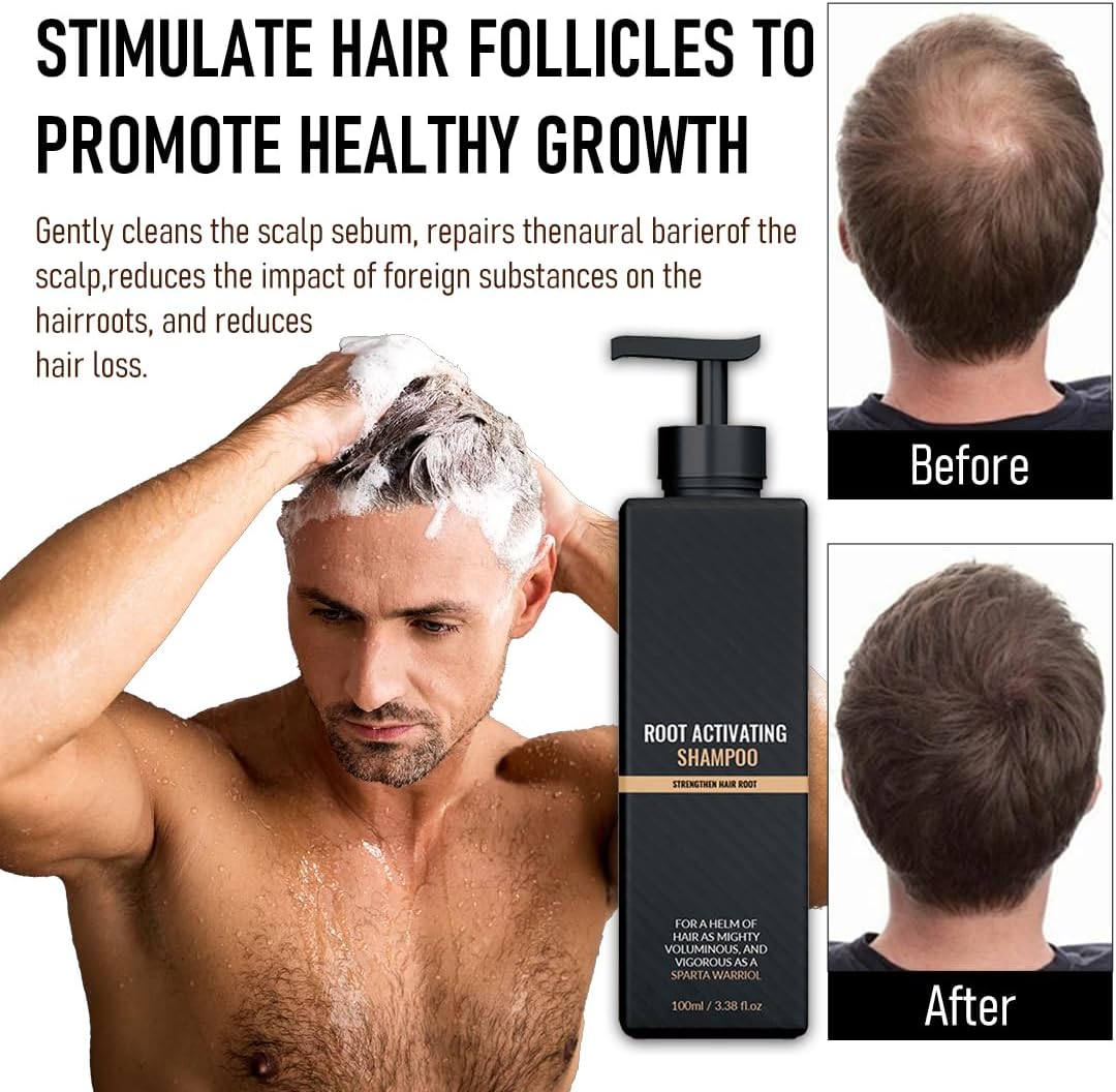 Spartan Shampoo, Spartan Root Activator Shampoo, Natural Hair Growth Shampoo 100 ml, Against Hair Loss Repairing Care Shampoo, Hair Care Promotes Hair Growth Women Men