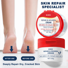 40% Urea Cream for Dry Foot, Cracked & Scaly Skin Moisturizing Hand Cream with 2% Salicylic Acid & Hyaluronic Acid, for Callus Treatment on Hands, Heels, Elbows, Nails & Knees