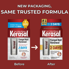 Kerasal Fungal Nail Renewal - Visible results start in just 1 week - 10ml