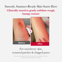 medicube Red Body Peeling Shot, Strawberry Skin Body Spray Cleanser, AHA + BHA + Succinic Acid, Exfoliating, 3.88 oz.
