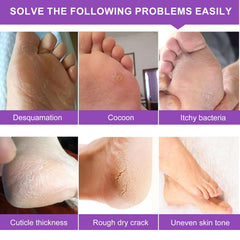 ALIVER Foot Peel Mask - 5 Pack, Exfoliating Feet Mask For Baby Soft Skin, Repair Dead Skin, Calluses, ed - Lavender