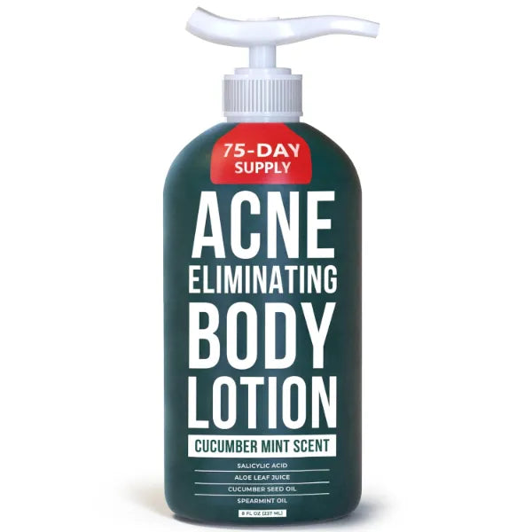 TreeActiv Acne Eliminating Body Lotion 8 fl oz | Clears Body, Back, Butt and Shoulder Acne | Anti-Acne Moisturizer | Prevents Future Breakouts | Cucumber Mint Scent