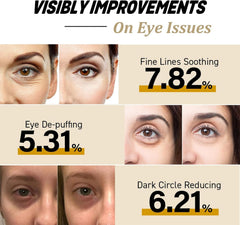 TERRIFI Eye Cream for Dark Circles, Advanced Snail Repair Eye Stick with Snail Mucin, Hydrating Cream for Puffiness and Bags Under Eyes, Reduces Fine Lines and Wrinkles (1pc)