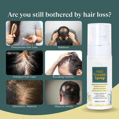 NALACAL Hair Growth Spray (2 FL OZ): Natural Formula with Batana, Castor, Rosemary Oil, Rice Water & Biotin – Scalp Care Treatment for Thinning Hair, Regrowth & Thickening for Women and Men