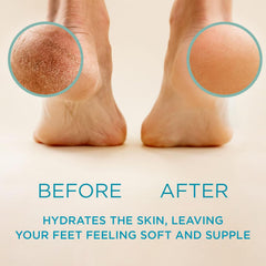 Lee Beauty Professional Best Callus Remover, Callus Eliminator, Liquid & Gel For Corn And Callus On Feet, Does Better Job Than Electric Shaver & foot scrubber.