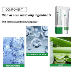 Excefore Acne Treatment Cream, 30 Day Supply, Treatment for Face with Aloe Essence, Gentle Skin Care for Acne Prone Sensitive Skin, Acne Cream Back Acne Treatment Cream for Teens & Adults, 20g Tube