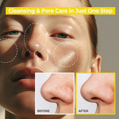 AVCA Korean Blackhead Remover Cleanasing Oil - Oil Cleanser for Face, Makeup Blackhead Remover, Normal & Oily Skin, Face Pore Cleanser 10.14 fl oz(300ml)